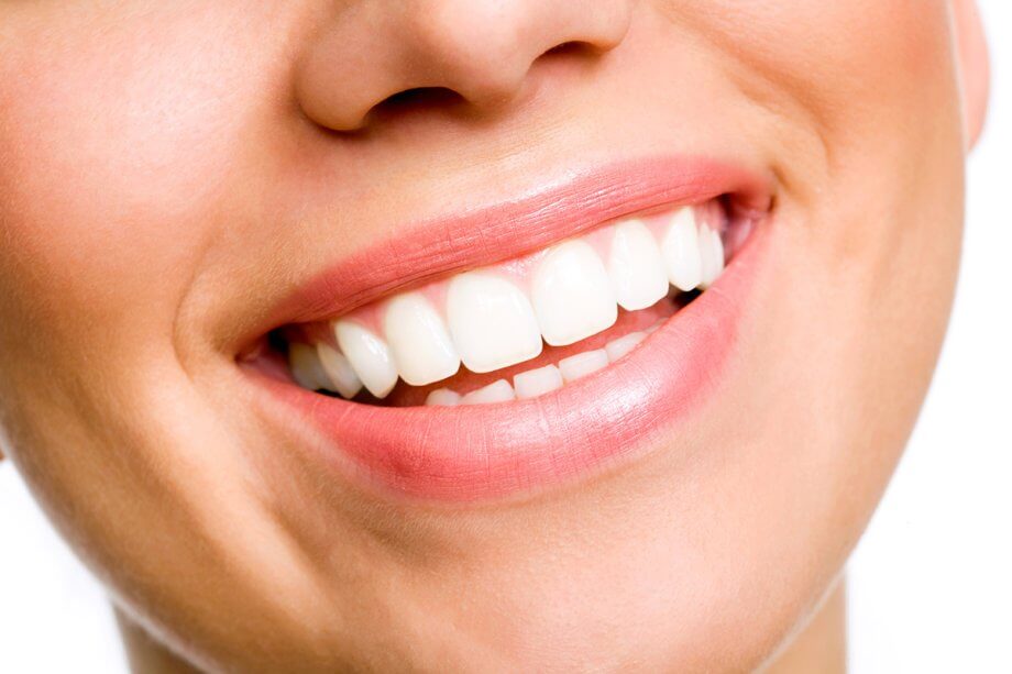 4 Tips for a More Photogenic Smile
