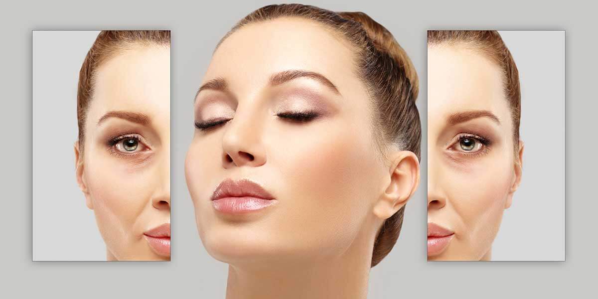 Juvéderm & Botox in Midtown East Manhattan