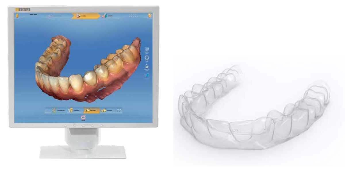 Invisalign in Midtown East Manhattan & NYC