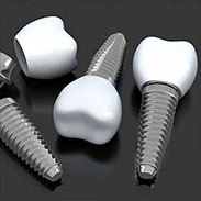 Dental Implants in Midtown East